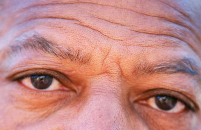 Wrinkled Man Face